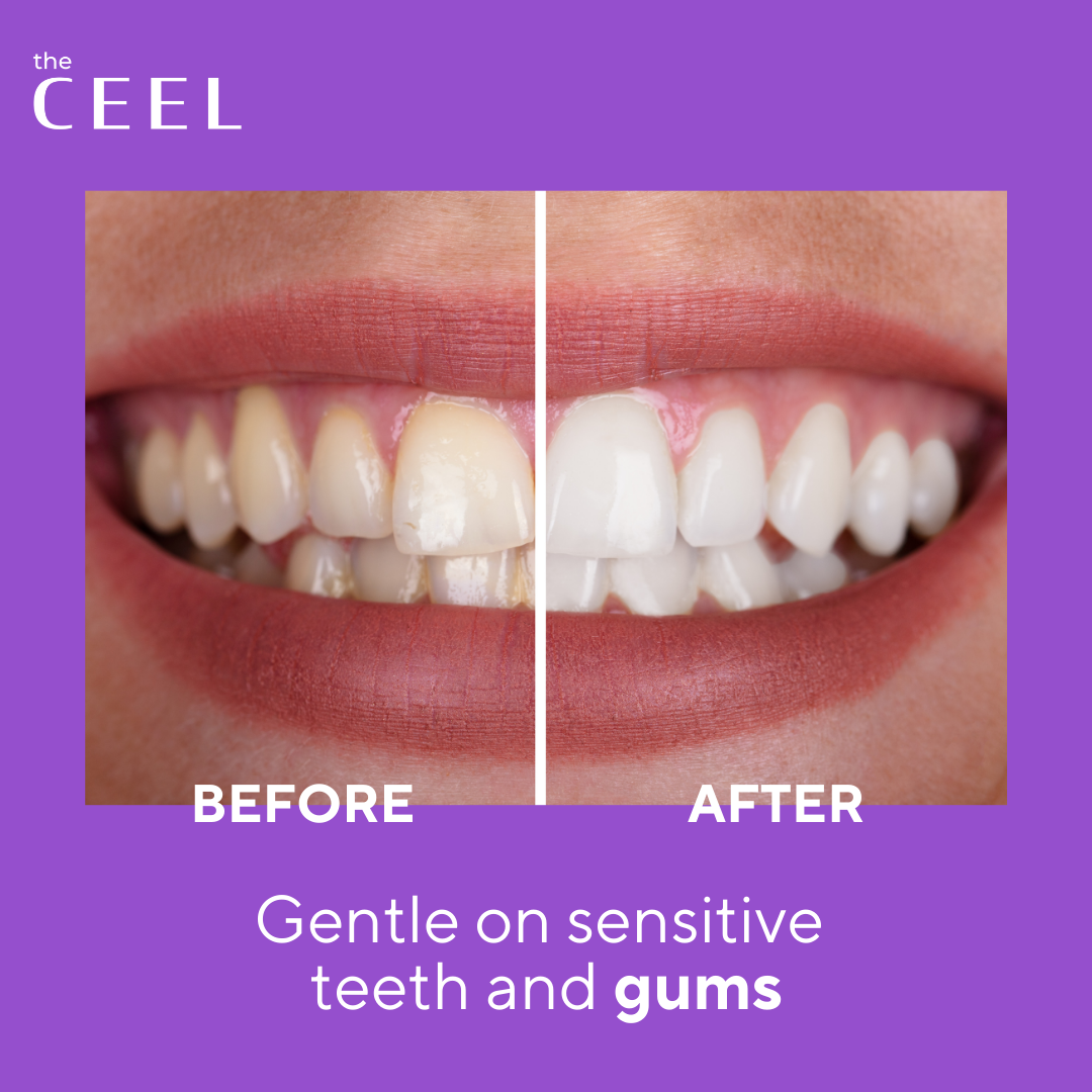 Ceel Ultimate Whitening Duo (Oral Care)