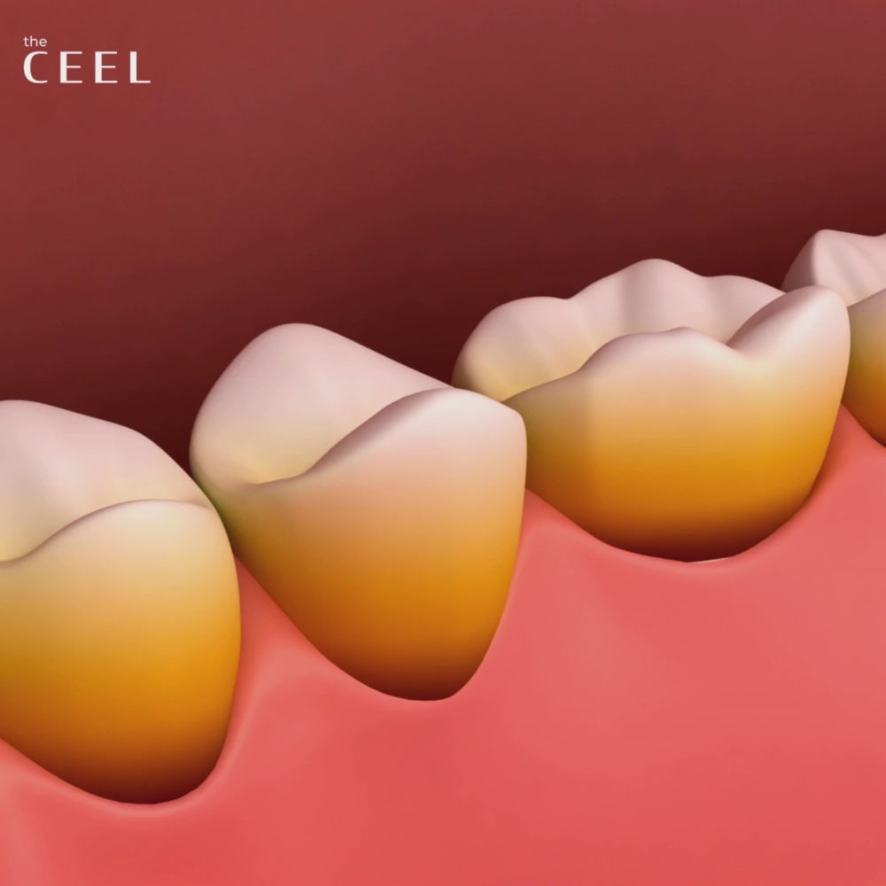 Load video: Ceel Ultimate Whitening Duo (Oral Care)