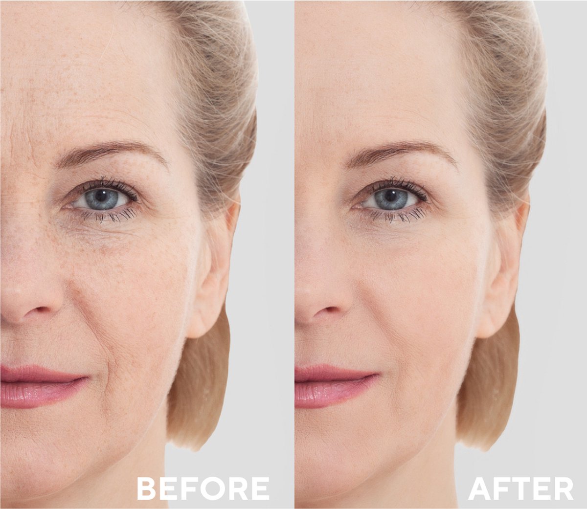 Ceel Natural Retinol Serum-30ml - Anti Wrinkle & Anti Aging With Retinol 1%, Ceramides and Niacinamide
