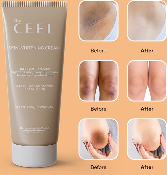 Ceel Bright Correct Set – Glutathione + Kojic Acid Formula – Whitening Cream 50ml + Dark Spot Corrector 30ml