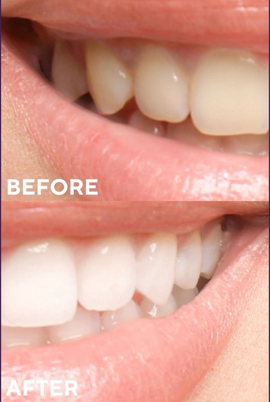 Ceel Carbon Purple Carbon Tootpaste -75g - Teeth Whitening & Oral Detox