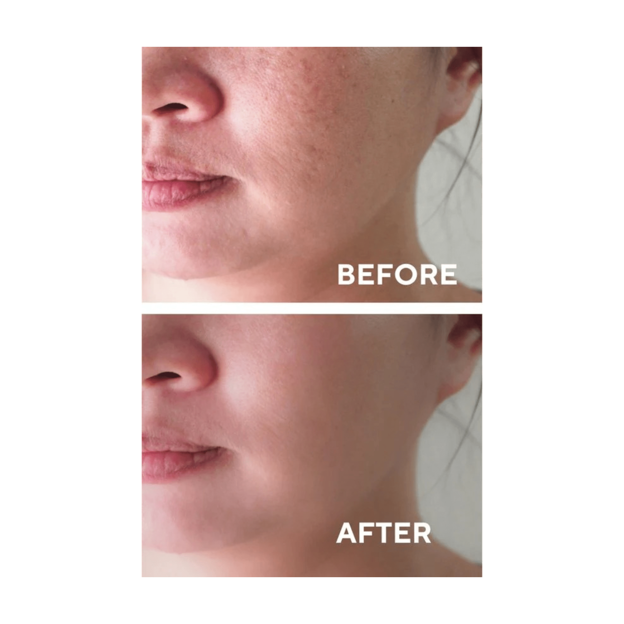 Ceel Natural AHA+BHA Red Peeling Serum - 30ml - Skin Dullness - Ceel AU