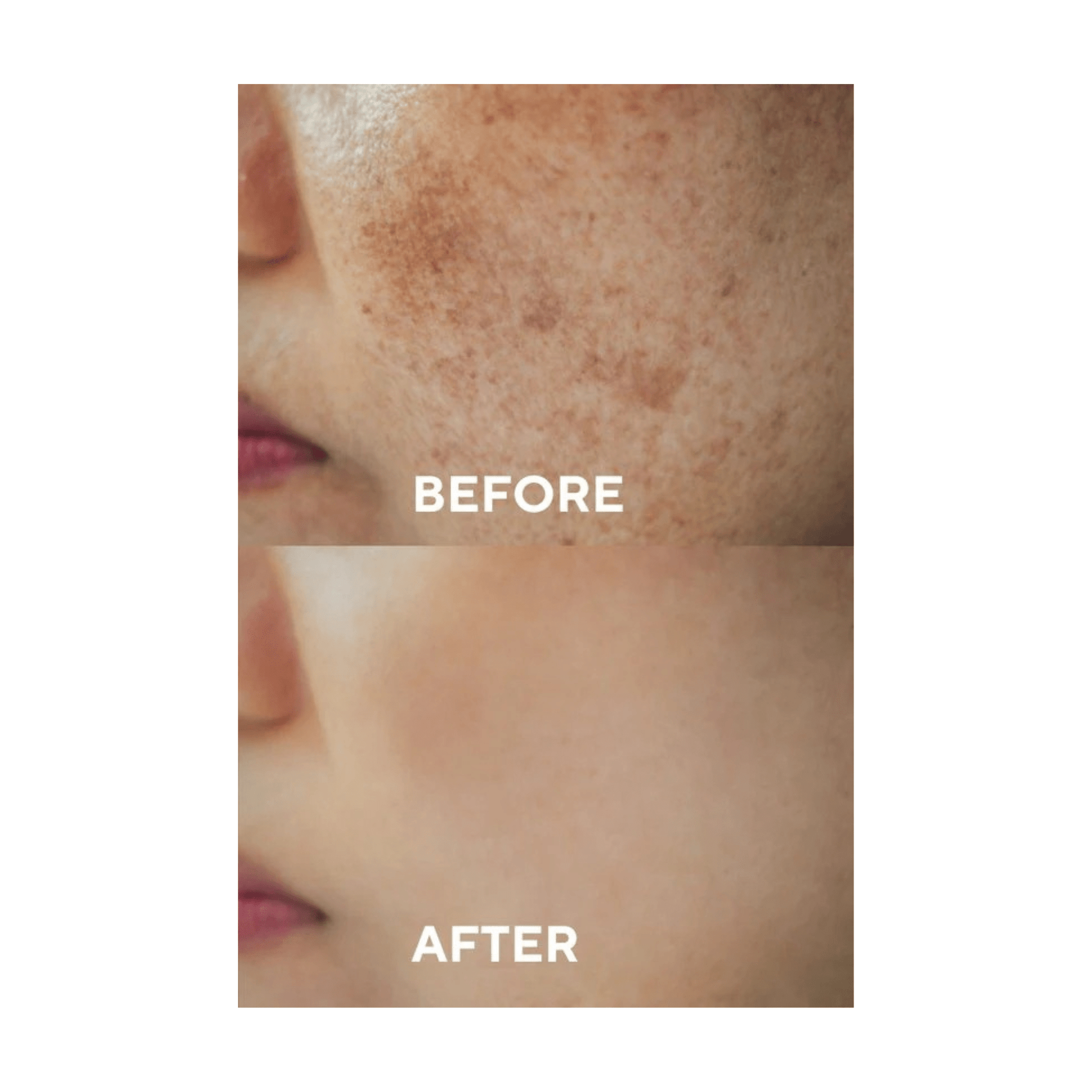 Ceel Natural Dark Spot Corrector Serum - 30ml - Dark Spots & Pigmentation With Glutathione Alpha Arbutin 2%, HyaluronicAcid and Niacinamide - Ceel AU