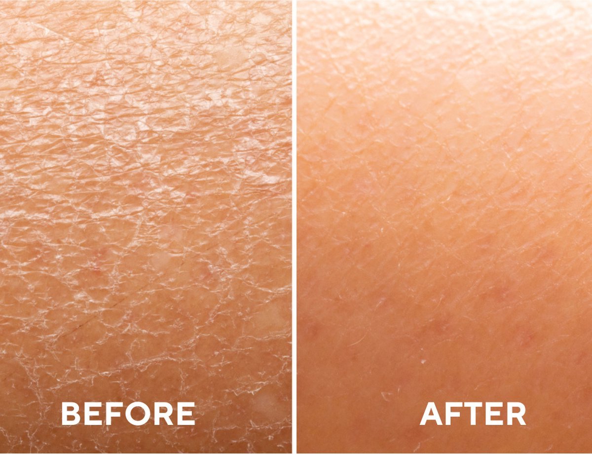 Ceel Natural Intensive Hydration Serum - 30ml - Moisturizing & Repair With Hyaluronic Acid and Vitamin B5 - Ceel AU