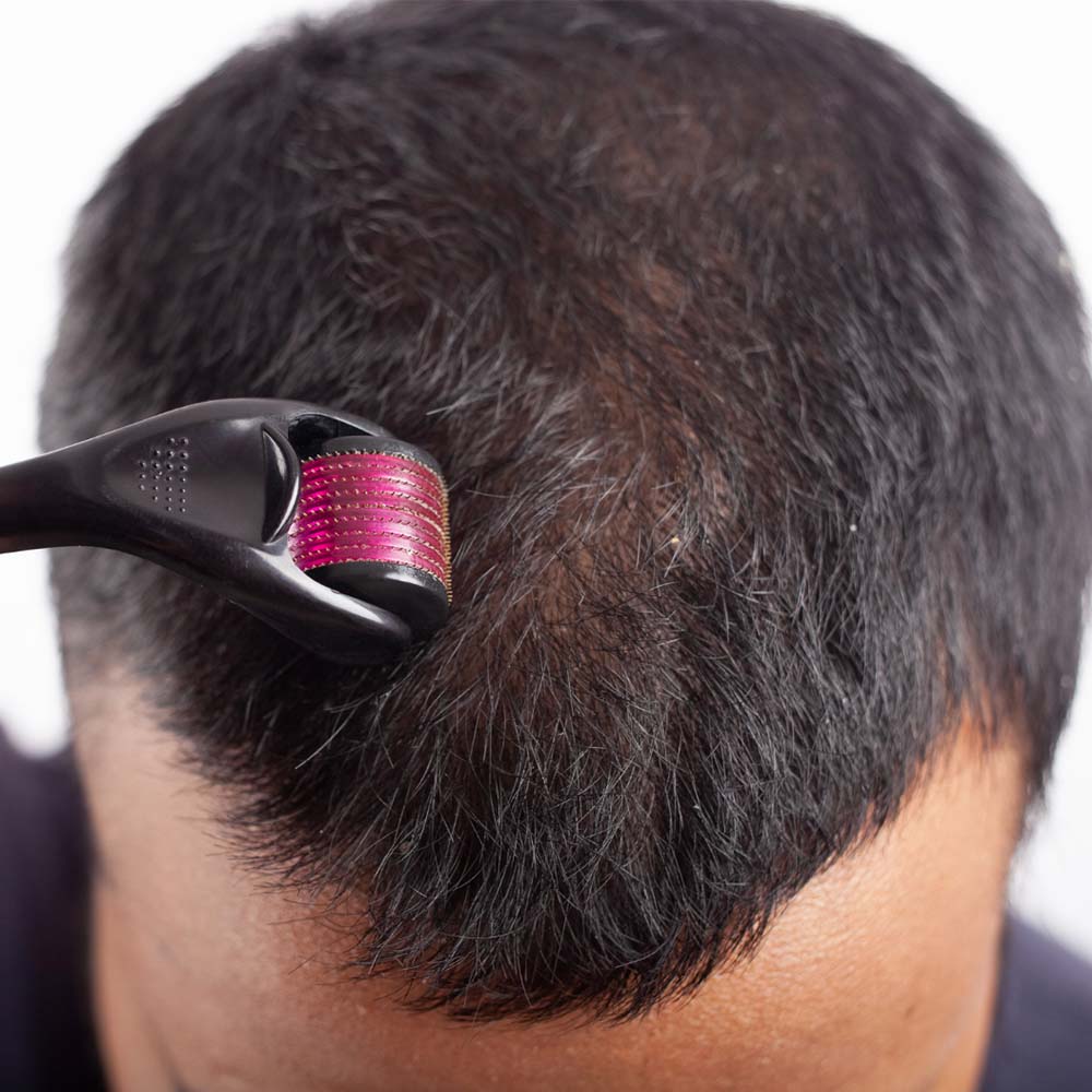 Ceel Rosemary Hair Oil - 50ml – Scalp and Hair Nourishment with Derma Roller 0.5mm - Ceel AU