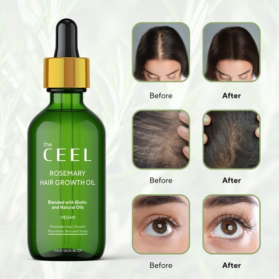Ceel Rosemary Hair Oil - 50ml – Scalp and Hair Nourishment with Derma Roller 0.5mm - Ceel AU