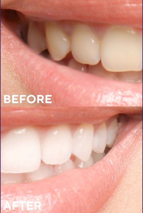 Ceel Ultimate Whitening Duo (Oral Care) - Ceel AU